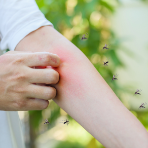 comment se proteger des moustiques tigres